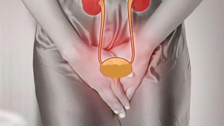 Urinary Dysfunction and Deep Endometriosis